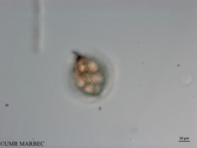 phyto/Brazilian_Nordeste/Seamounts_station56/ABRACOS2 April 2017/Phalacroma porodictyum (Snap-411)(copy)_thumb.jpg